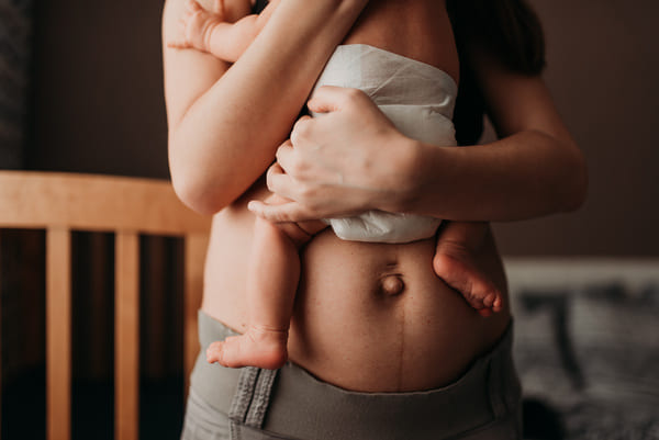 mommy makeover