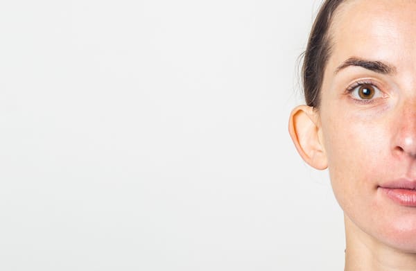 redukcja-odstsajacych-uszu