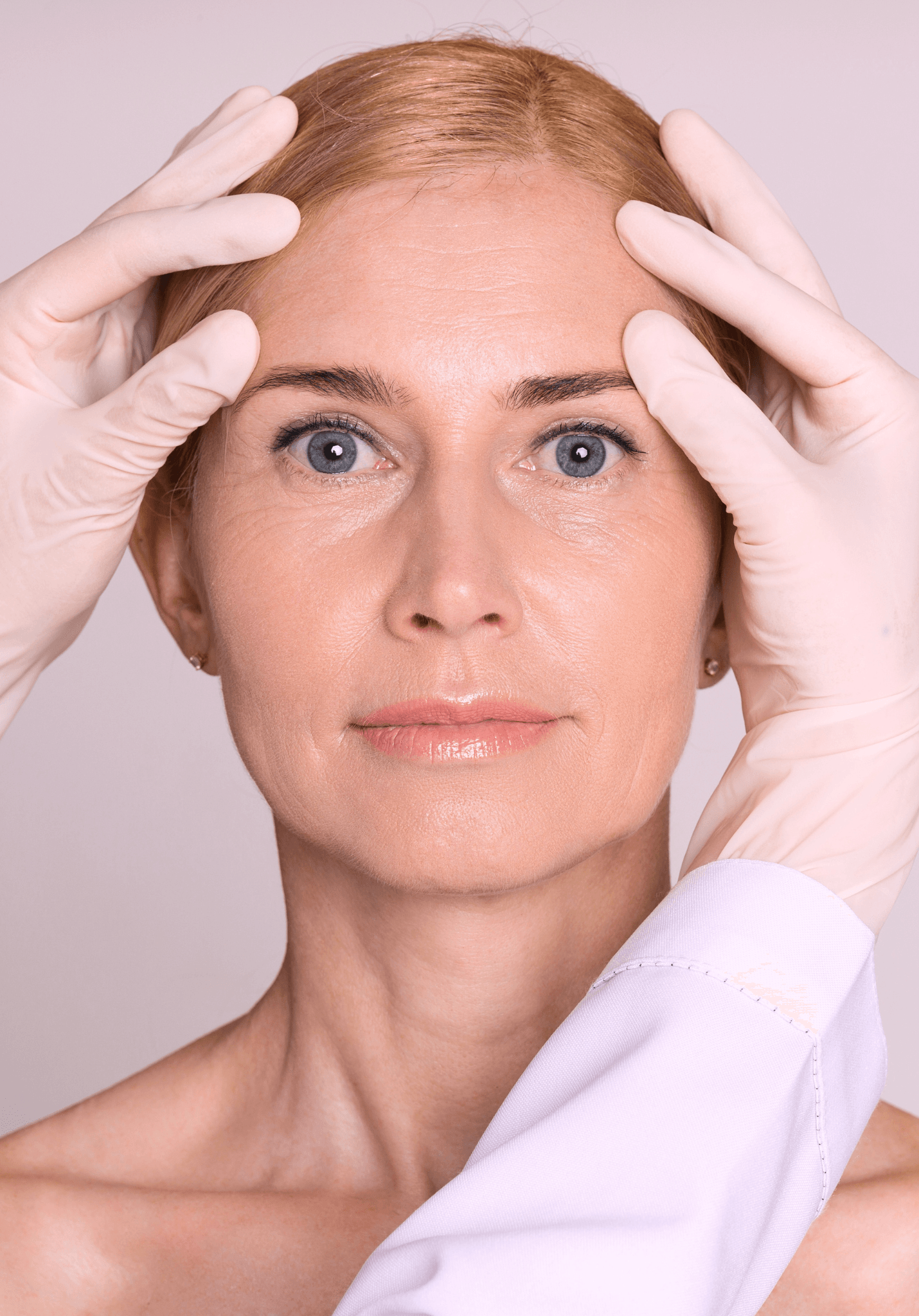 Browlift
